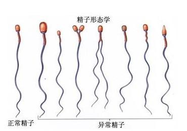 化学剂和噪声都可导致弱精症