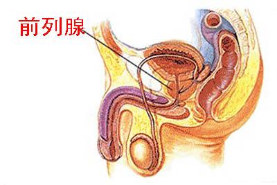 前列腺炎病因