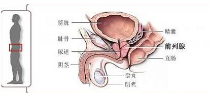 男人导致前列腺炎