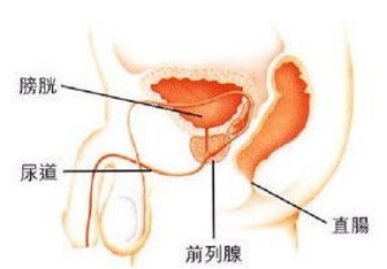 前列腺炎的四种危害