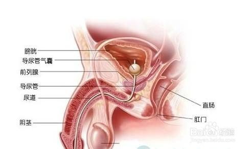 前列腺炎的危害