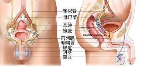 前列腺囊肿会疼痛吗